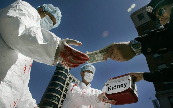 Poverty in Pakistan triggers boost in Illegal Kidney Trade